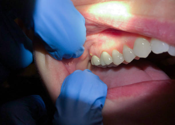 Best Emergency Orthodontic Repairs in Springdale, OH