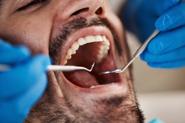 Best Emergency Treatment for Toothache in Springdale, OH